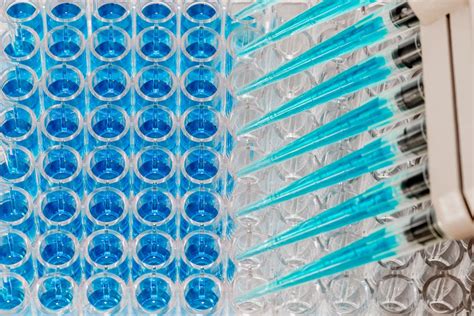 Enzyme Linked Immunosorbent Assay 